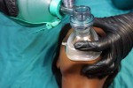 Airway Management (AM)
